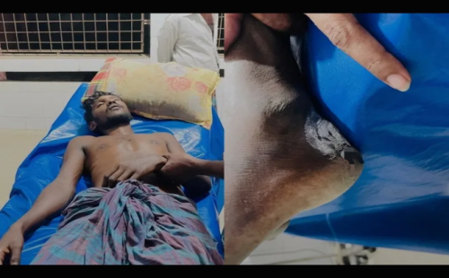 সাপের কামড়ে যুবকের মৃত্যু